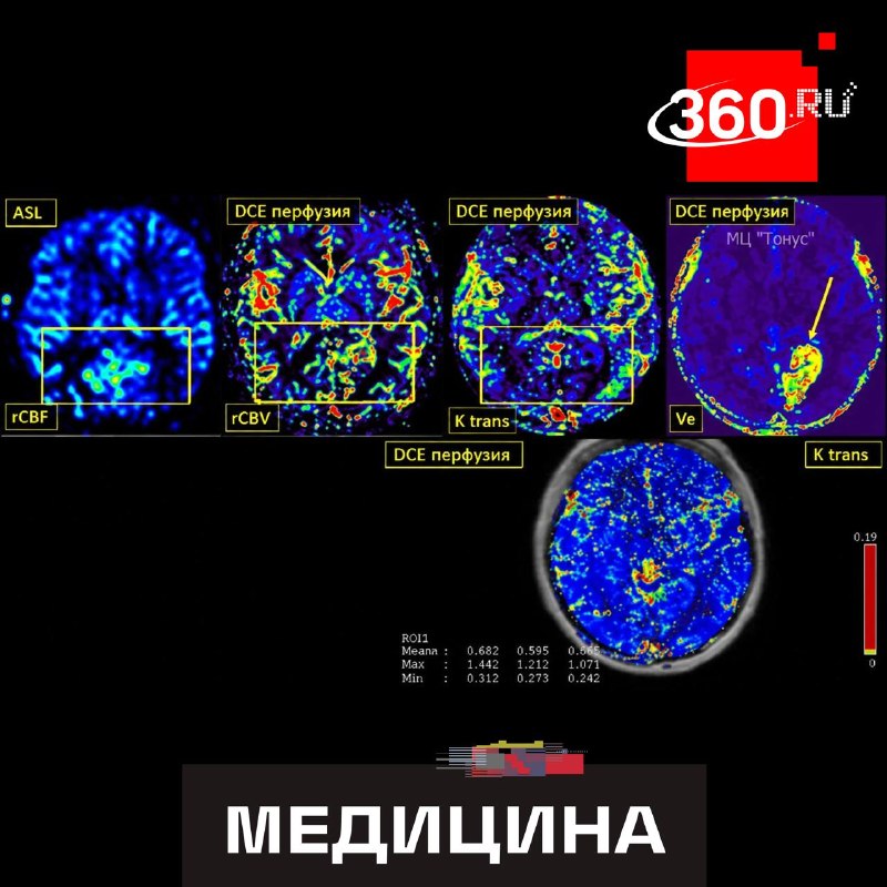 Фото поста канала  360.ru