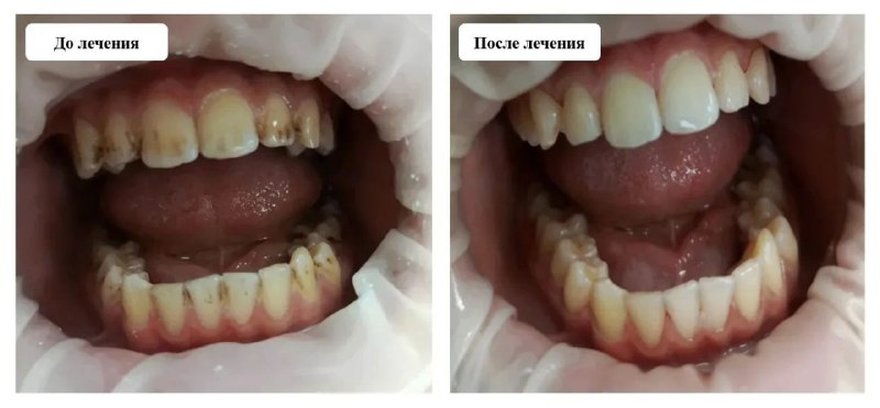 Фото поста канала  МОЁ! Online. Воронеж