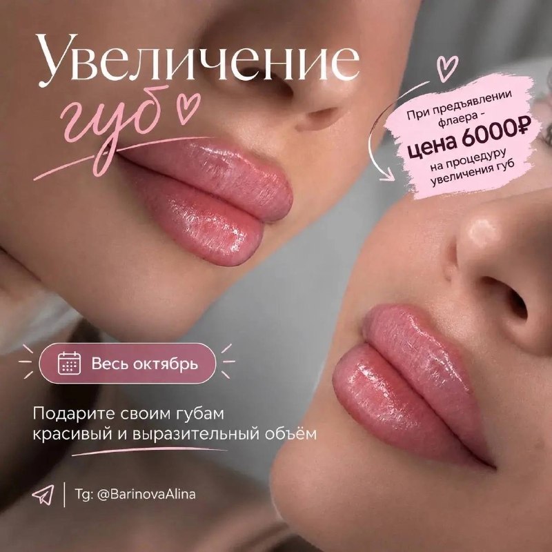 Фото поста канала  Это Юганск, детка!
