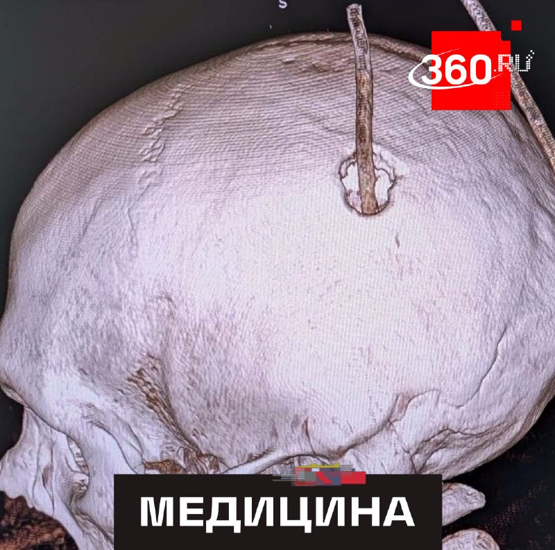 Фото поста канала  360.ru