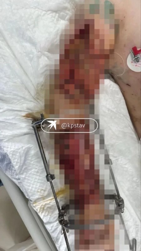 Фото поста канала Нетипичный Ставрополь️