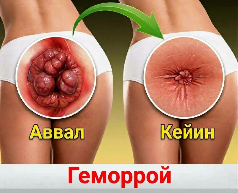Фото поста канала  Tezkor Yangiliklar ⚡
