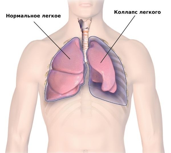 Фото поста канала Топор Live