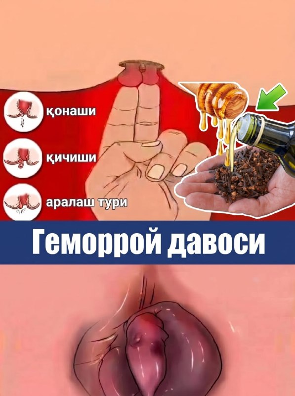 Фото поста канала  Tezkor Yangiliklar ⚡