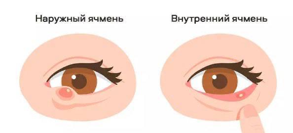 Фото поста канала  Курсы тактической медицины
